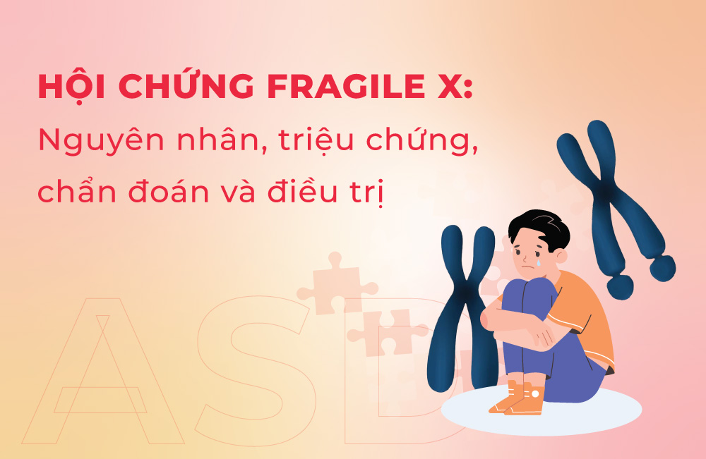 Hội chứng Fragile X Nguyên nhân, triệu chứng, chẩn đoán và điều trị